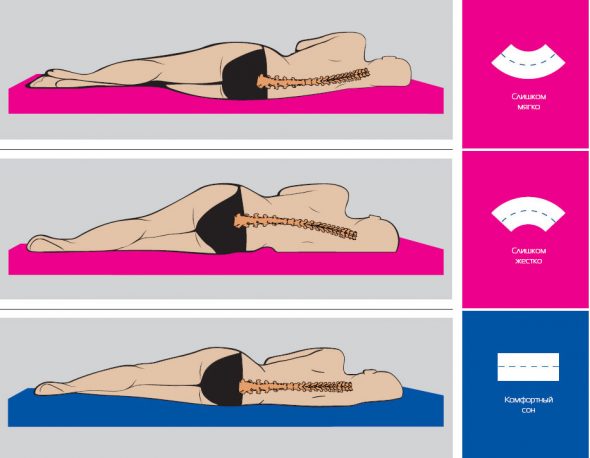 Ортопедические подушки для сна при остеохондрозе шеи